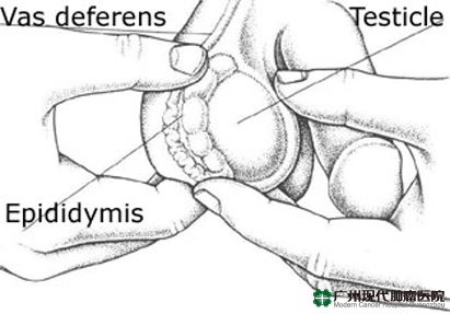 KANKER TESTIS 2