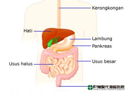 Kanker usus 12 jari 