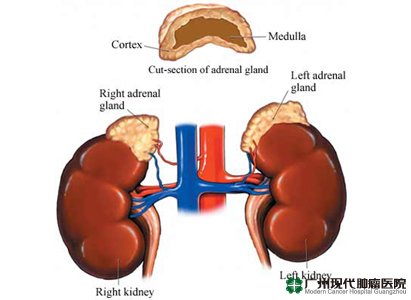 KANKER ADRENAL