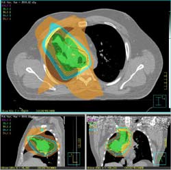 PET/CT