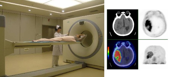 PET/CT