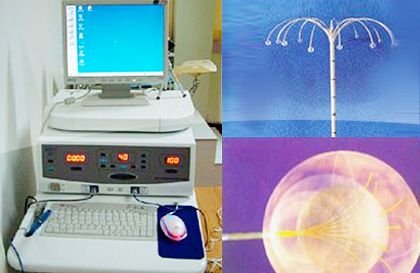 RFA: A Therapy to Depress And kill Tumor Heat Tumor to Coagulation Necrosis