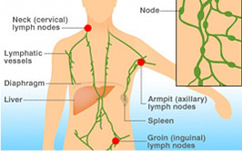 125I brachytherapy