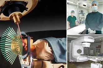 Dao động lực: Xạ trị ba chiều, định vị, hình thái xạ thích hợp- xạ nhiều tia, không đồng vị, hình thái thích hợp