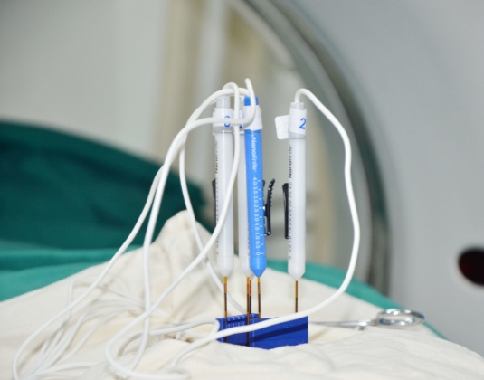 Nanoknife Technology