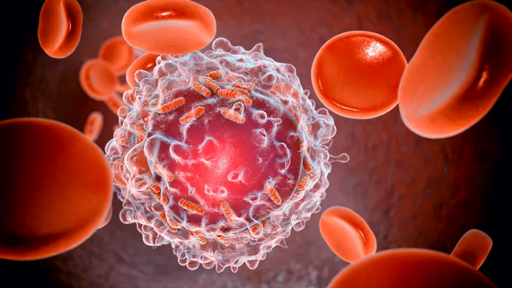 Leukemia