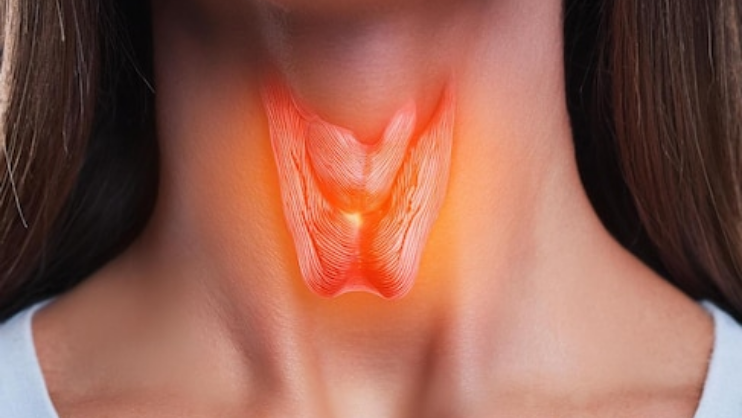 Lymphoma