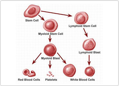 Leukemia Symptoms