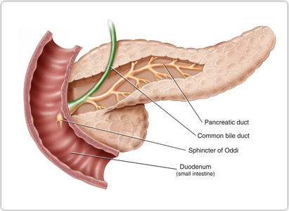 Pancreatic Cancer Symptoms