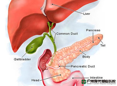 Cancerul Pancreatic: Simptome, Cauze, Tratament