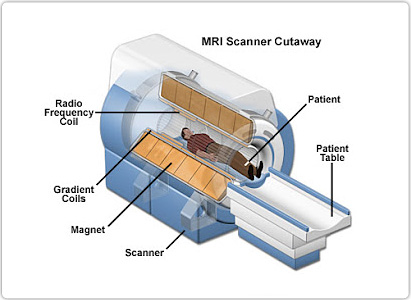 Brain Tumor Diagnosis