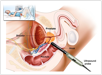 Prostate Stimulated