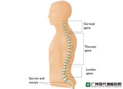 Cervical spondylosis