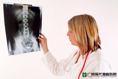 Cervical spondylosis 3