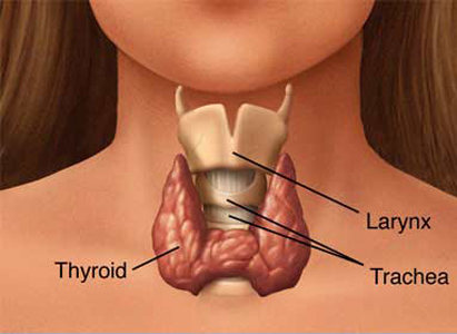 Gejala kanker tiroid