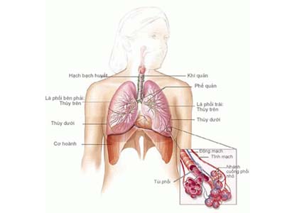 Chẩn đoán ung thư phổi