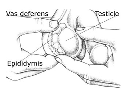 Diagnosa Kanker Testis