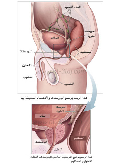  تشخيص سرطان القضيب