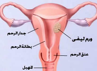 اعراض السرطان بشكل عام