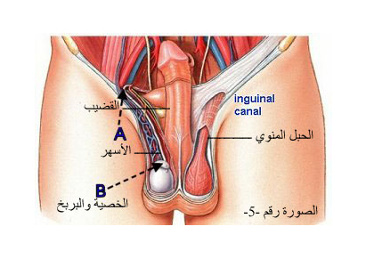  سرطان الخصية 