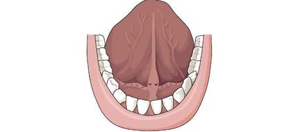 ជម្ងឺមហារីកអណ្តាត