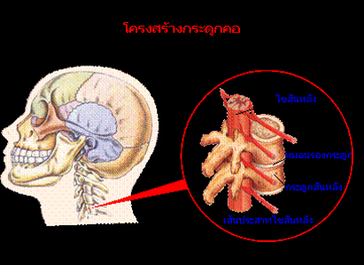 โรคกระดูกสันหลังคอเสื่อม 1